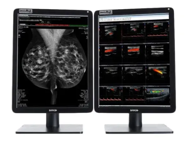 Barco Nio Color 5MP MDNC