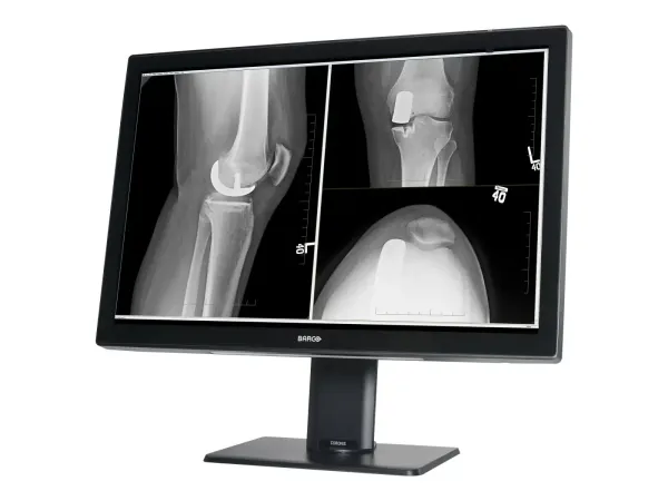 Barco Coronis Fusion 4MP (MDCC