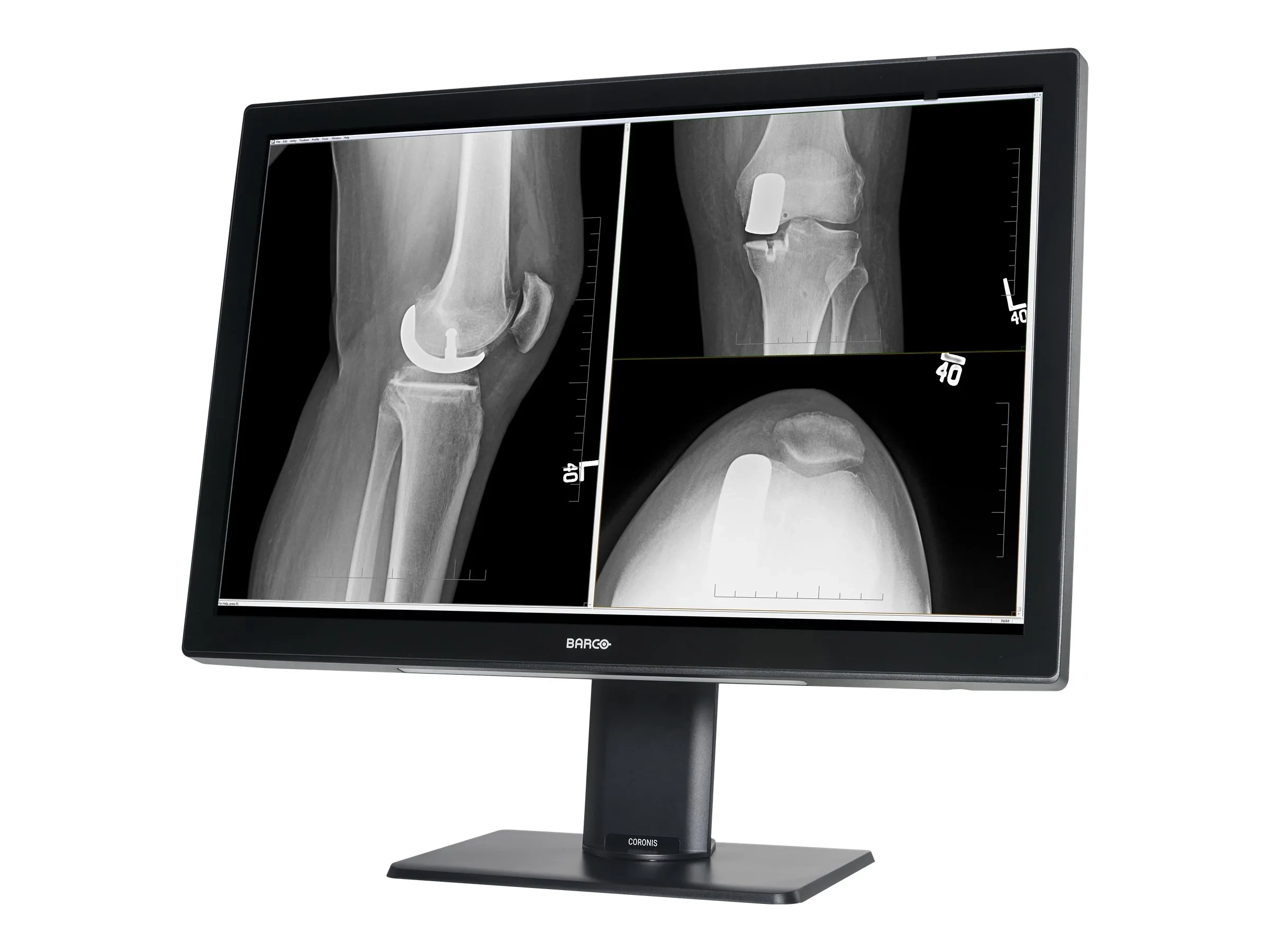 Barco Coronis Fusion 4MP (MDCC